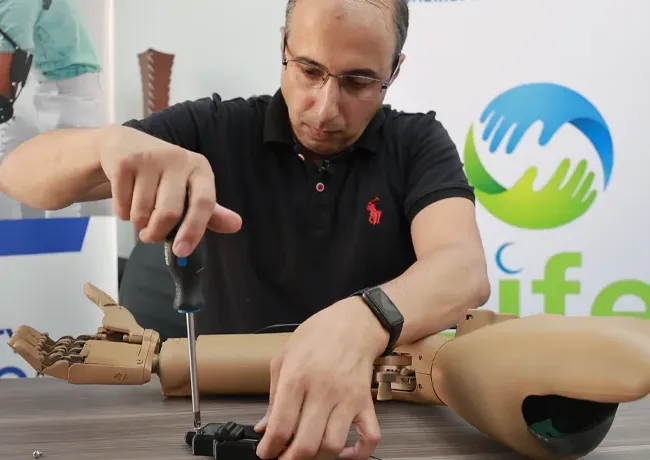 Prosthetic Limb Project in Egypt to Support Mobility and Independence